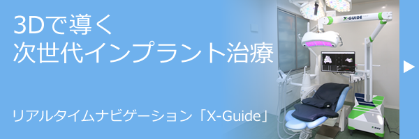 X-Guideバナー